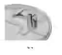 Fig. 13 - Double entry channel ladle bottom
