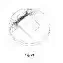Fig. 19 - Double entry channel ladle bottom