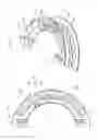 Fig. 06 - CABLE HOUSING DEVICE