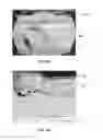 Fig. 04 - Under ball metallurgy (UBM) for improved electromigration