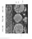 Fig. 13 - Porous ceramic article and method of manufacturing the same