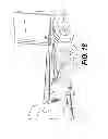 Fig. 13 - Front tow extended saddle