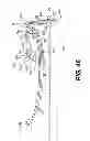 Fig. 33 - Front tow extended saddle