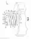 Fig. 06 - Mechanical friction enhancement for threaded connection incorporating opposing barb