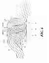 Fig. 07 - Stator of segmented conductor type electric rotary machine and fabrication method thereof
