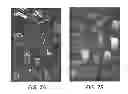 Fig. 08 - Online coupled camera pose estimation and dense reconstruction from video