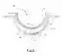 Fig. 02 - Ophthalmic lens with communication system