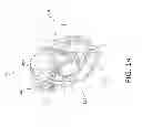Fig. 14 - Lens barrel including blur correcting mechanism and rotatable retracting lens