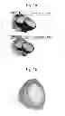Fig. 02 - Reflector having reflection pattern for compensating for lighting characteristic of LED package and LED lamp including the same