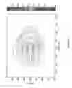 Fig. 49 - System and methods of photon-based radiotherapy and radiosurgery delivery