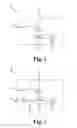 Fig. 02 - Hearing device and a method for receiving wireless audio streaming