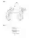Fig. 02 - Method and hearing aid system for logic-based binaural beam-forming system