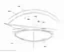 Fig. 01 - Method and apparatus for automated placement of scanned laser capsulorhexis incisions