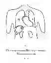 Fig. 02 - SYSTEM AND METHOD FOR EFFICIENT ASSESSMENT OF LESION DEVELOPMENT