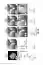 Fig. 32 - Methods, systems and computer program products for diagnosing conditions using unique codes generated from a multidimensional image of a sample