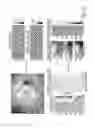 Fig. 33 - Methods, systems and computer program products for diagnosing conditions using unique codes generated from a multidimensional image of a sample