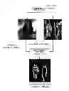 Fig. 01 - Shadow detection method and device