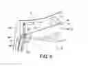 Fig. 07 - Unlockable device for axially arresting a sealing ring with which an aircraft turbomachine module rotor wheel makes contact