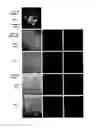 Fig. 05 - PROVASOPRESSIN ANTAGONISTS AND USES THEREOF