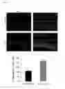 Fig. 03 - METHODS OF INHIBITING PHOTORECEPTOR APOPTOSIS