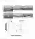 Fig. 04 - METHODS OF INHIBITING PHOTORECEPTOR APOPTOSIS