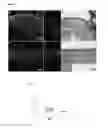 Fig. 08 - METHODS OF INHIBITING PHOTORECEPTOR APOPTOSIS