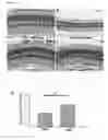 Fig. 10 - METHODS OF INHIBITING PHOTORECEPTOR APOPTOSIS