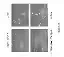 Fig. 34 - Neuron generation, regeneration and protection
