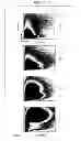 Fig. 06 - ADULT MESENCHYMAL STEM CELL (MSC) COMPOSITIONS AND METHODS FOR PREPARING THE SAME