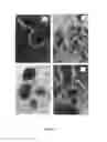 Fig. 10 - REGENERATIVE TISSUE MATRIX