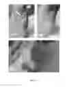 Fig. 11 - REGENERATIVE TISSUE MATRIX