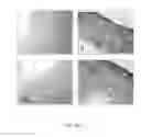 Fig. 06 - DEXTRAN-BASED TISSUELETTE CONTAINING PLATELET-RICH PLASMA LYSATE FOR CARTILAGE REPAIR