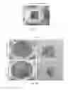 Fig. 17 - DEXTRAN-BASED TISSUELETTE CONTAINING PLATELET-RICH PLASMA LYSATE FOR CARTILAGE REPAIR
