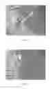 Fig. 20 - DEXTRAN-BASED TISSUELETTE CONTAINING PLATELET-RICH PLASMA LYSATE FOR CARTILAGE REPAIR
