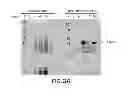 Fig. 04 - PSEUDOMONAS AERUGINOSA OprM EPITOPES FOR USE IN DIAGNOSTICS AND THERAPEUTICS