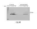 Fig. 09 - PSEUDOMONAS AERUGINOSA OprM EPITOPES FOR USE IN DIAGNOSTICS AND THERAPEUTICS