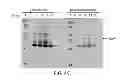 Fig. 10 - PSEUDOMONAS AERUGINOSA OprM EPITOPES FOR USE IN DIAGNOSTICS AND THERAPEUTICS