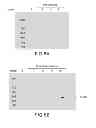 Fig. 13 - PSEUDOMONAS AERUGINOSA OprM EPITOPES FOR USE IN DIAGNOSTICS AND THERAPEUTICS