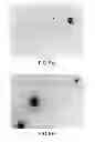 Fig. 15 - PSEUDOMONAS AERUGINOSA OprM EPITOPES FOR USE IN DIAGNOSTICS AND THERAPEUTICS