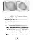 Fig. 16 - Methods of treating lung cancer