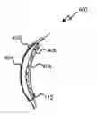 Fig. 01 - Non-invasive refractive treatment using nanoparticles
