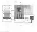 Fig. 04 - Structures and methods related to detection, sensing, and/or mitigating undesirable structures or intrusion events on structures