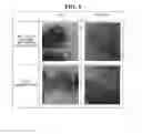 Fig. 05 - Si-BLOCK COPOLYMER CORE-SHELL NANOPARTICLES TO BUFFER VOLUMETRIC CHANGE AND ANODE ACTIVE MATERIAL FOR LITHIUM SECONDARY BATTERY USING THE SAME