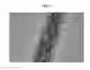 Fig. 07 - Negative active material for rechargeable lithium battery, method for preparing same, and rechargeable lithium battery including same