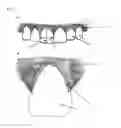 Fig. 02 - Gum tissue guide, systems and methods of producing and utilizing the same