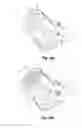 Fig. 09 - NUT FOR DENTAL IMPLANT