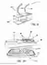 Fig. 06 - Hernia model