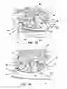 Fig. 09 - Hernia model