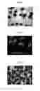 Fig. 02 - Method of cryopreservation of tissue derived from pluripotent stem cells