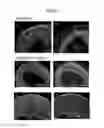 Fig. 06 - Method of cryopreservation of tissue derived from pluripotent stem cells